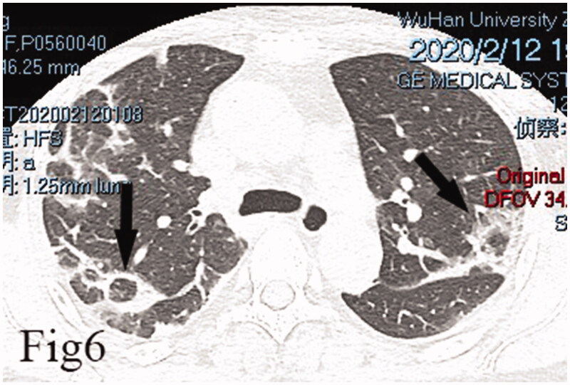 Figure 6.