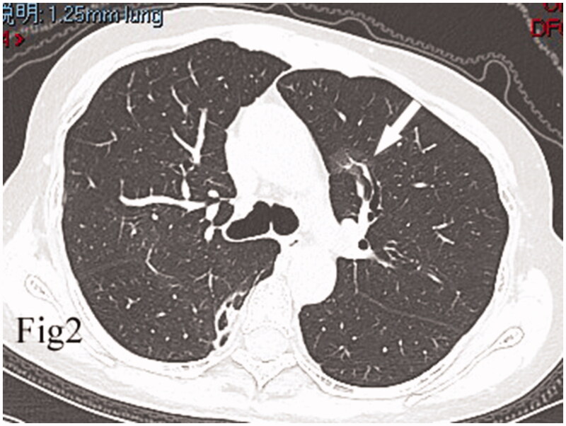 Figure 2.