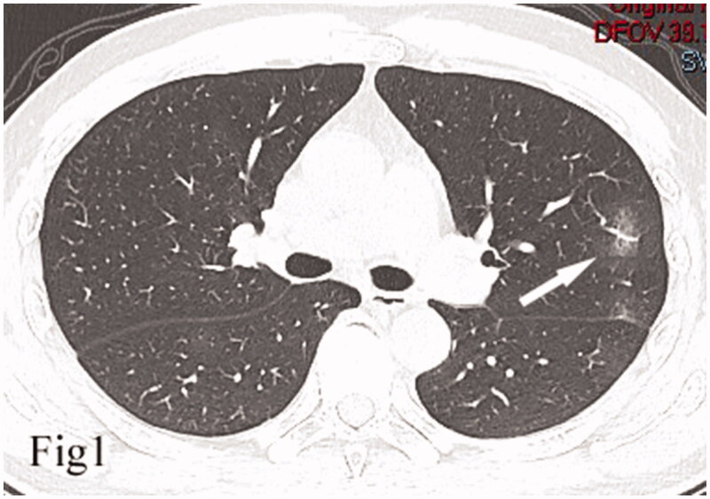 Figure 1.