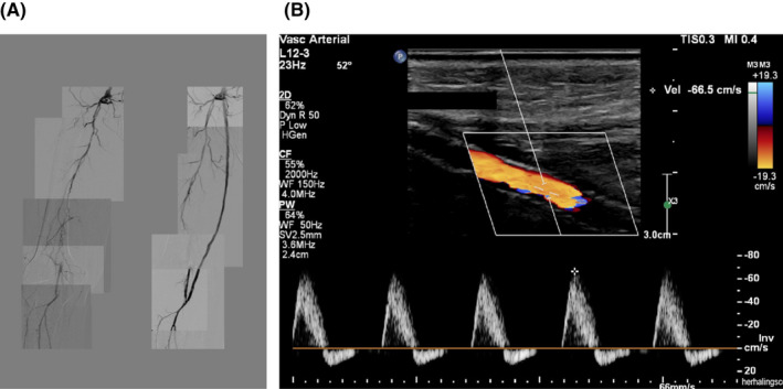 FIGURE 2