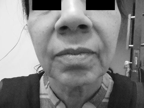 Fig. 3
