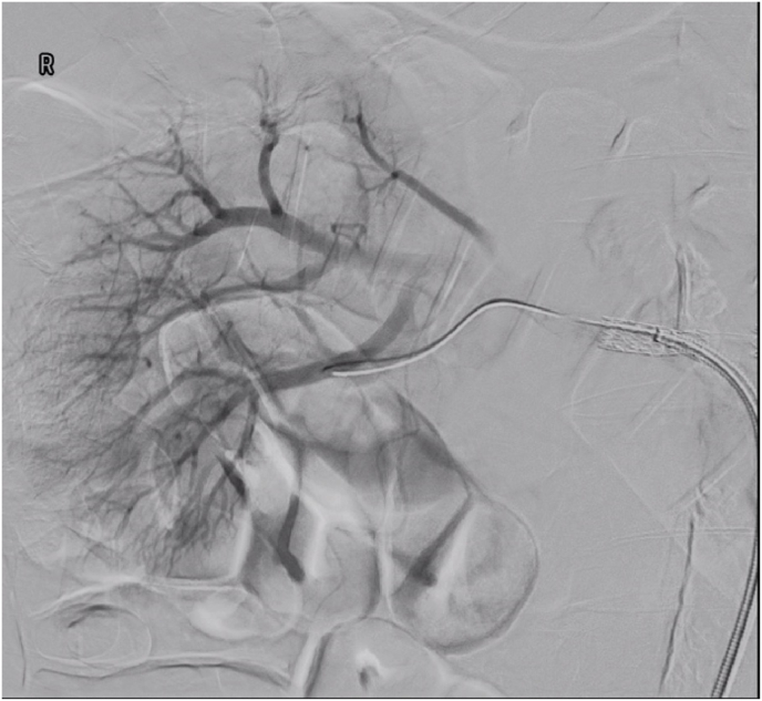 Fig. 2b