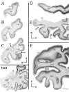 Fig.2