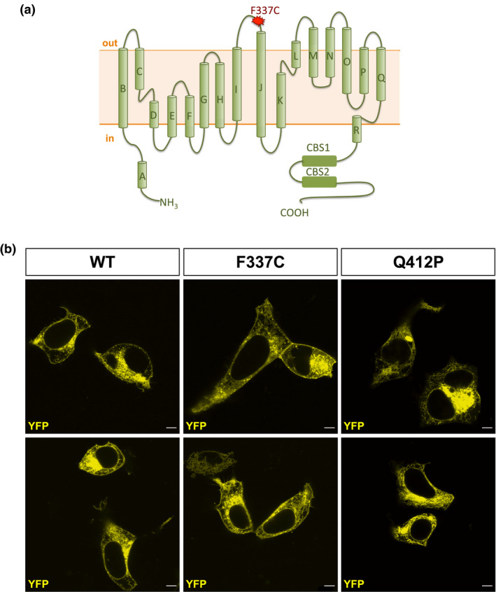 FIGURE 1