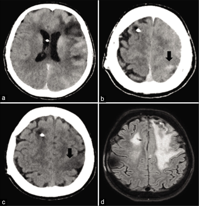 Figure 1: