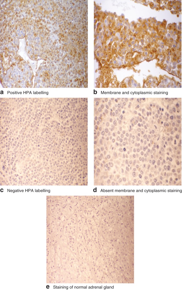 BJS5-70-FIG-0001-c