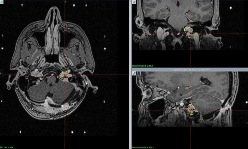 Fig. 1