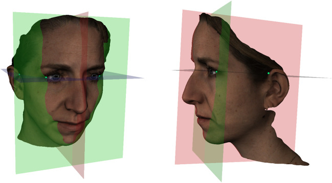 Fig. 1