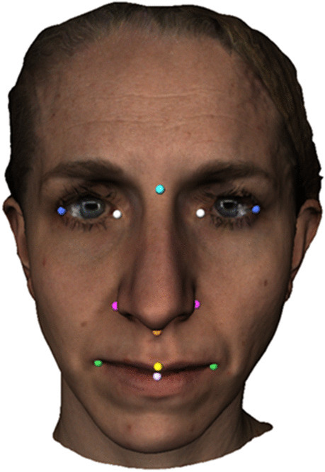 Fig. 2