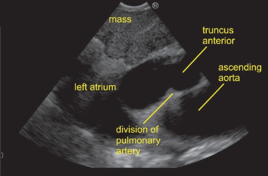 Figure 43