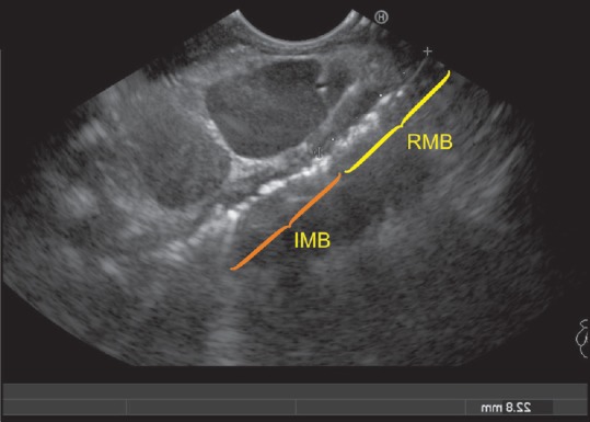 Figure 41