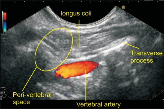 Figure 15