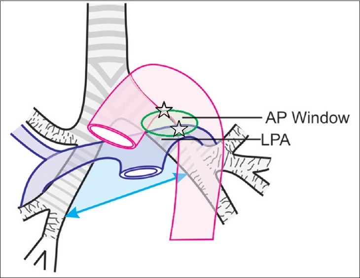 Figure 30