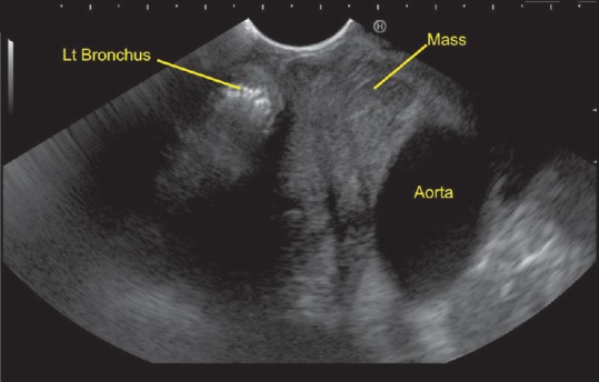 Figure 33