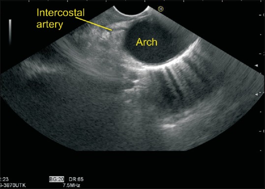 Figure 34