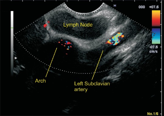 Figure 28