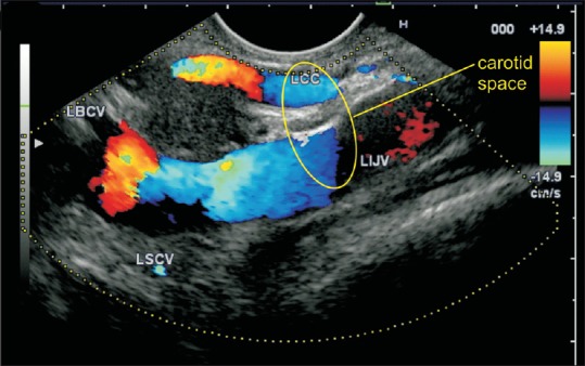 Figure 13