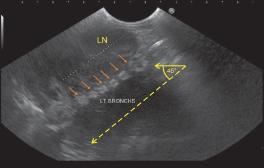 Figure 42