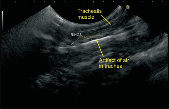 Figure 19