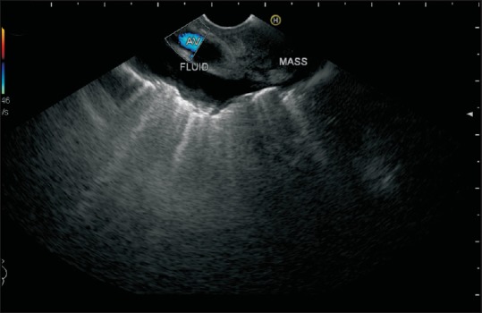 Figure 44