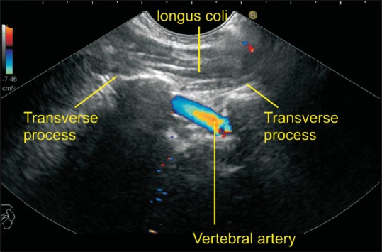 Figure 16