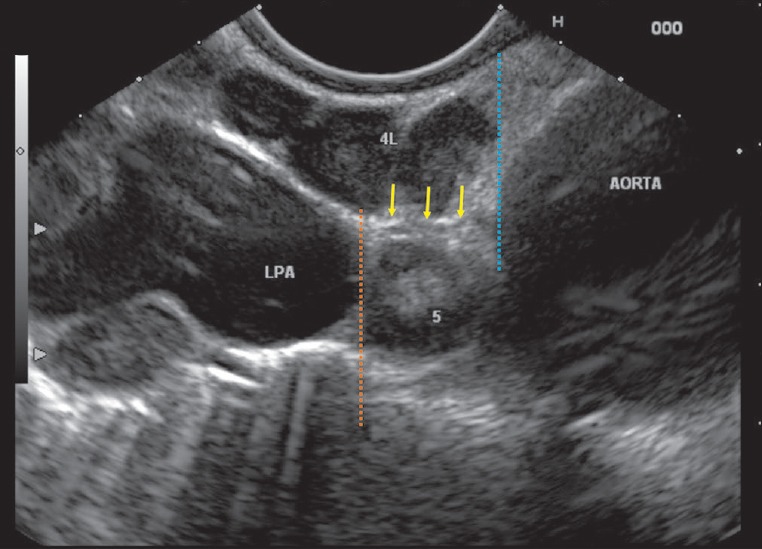 Figure 31