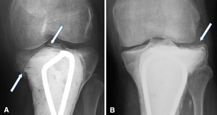 Fig. 2A–B