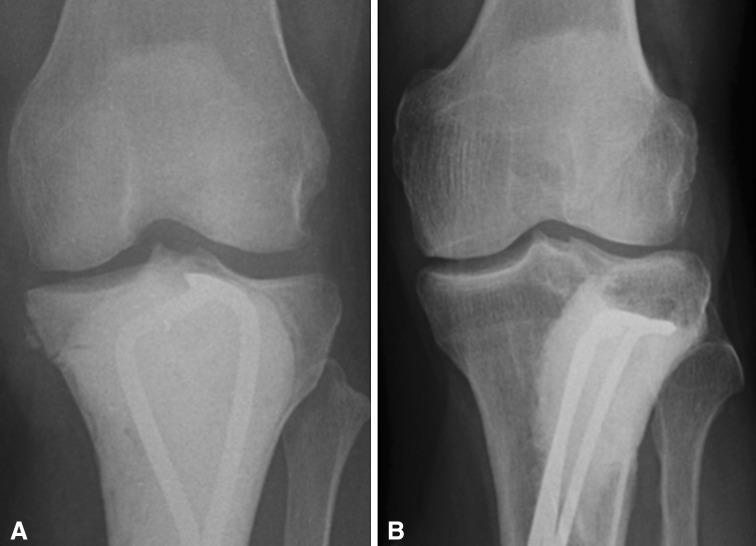 Fig. 1A–B