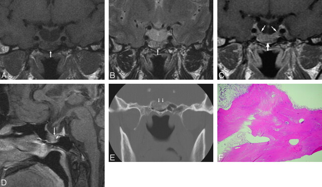 Fig 1.