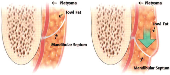 Fig. 15.