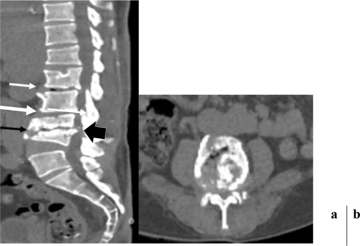 Fig 1: