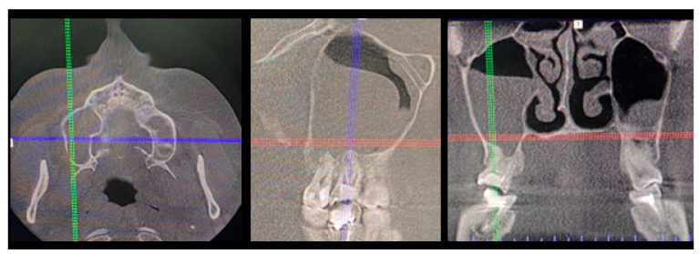 Figure 5