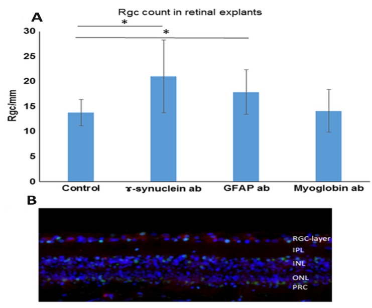 Fig. (1)