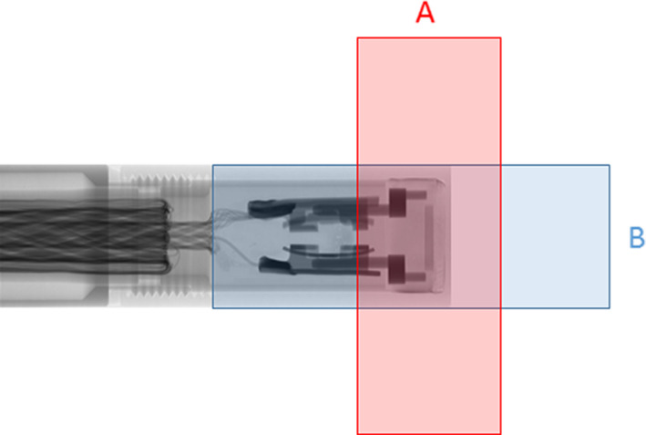 Fig. 3