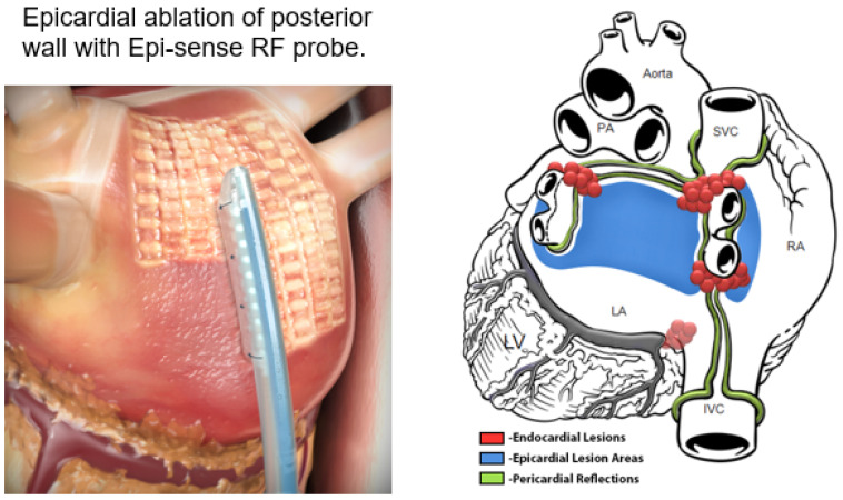 Figure 20