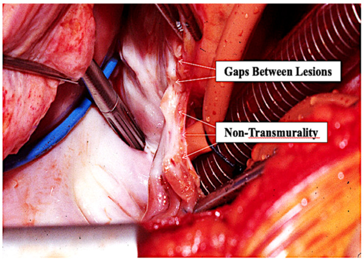 Figure 12