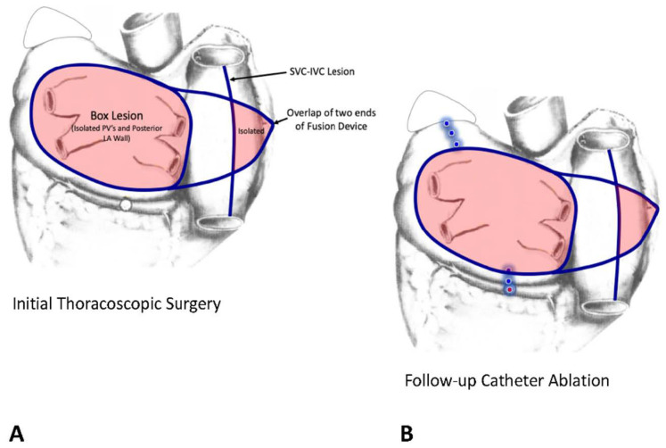 Figure 17