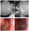 Fig. 1