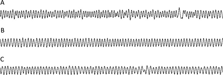 Figure 1