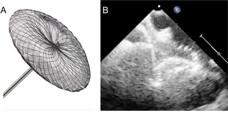 Figure 2: