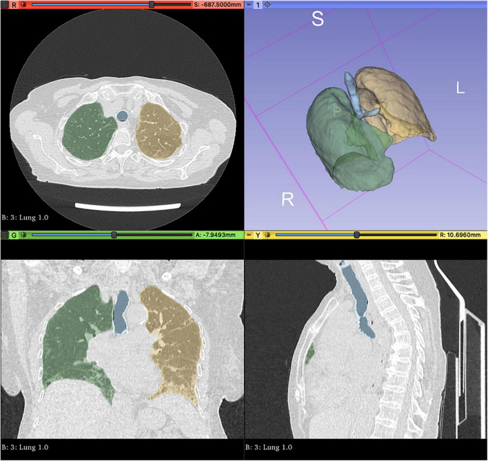 FIGURE 2