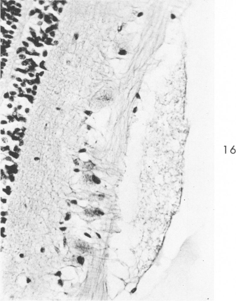 Fig. 16