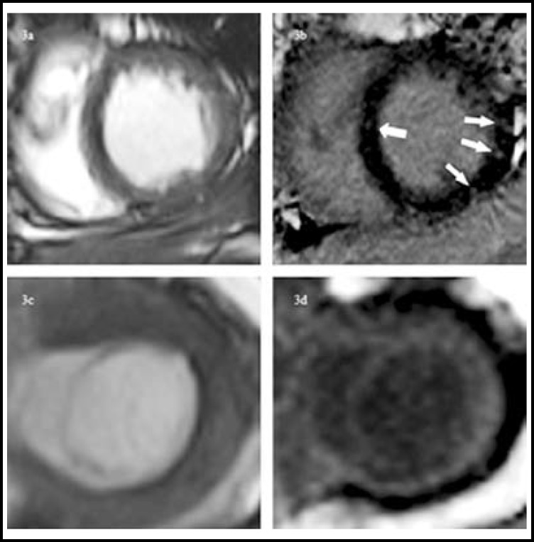 Fig.3