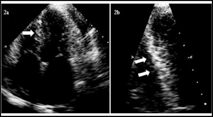 Fig.2