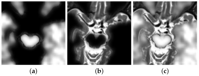 Figure 11