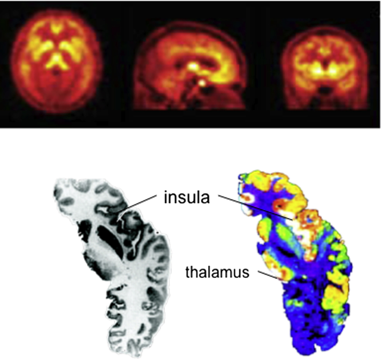 Fig. 1