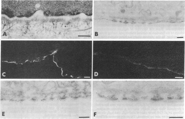 graphic file with name pnas01047-0296-a.jpg