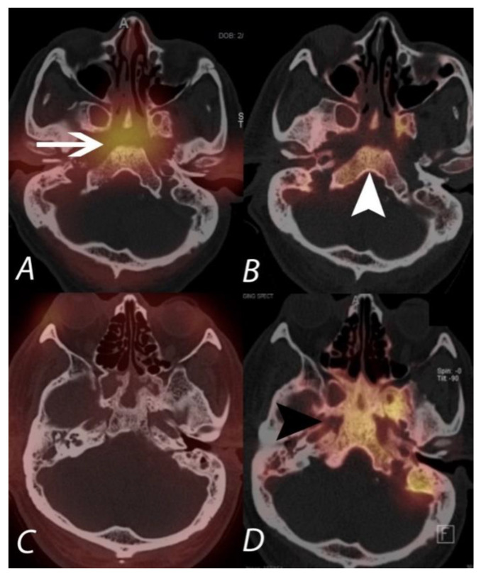 Figure 15