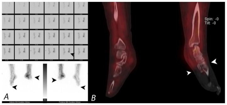 Figure 17