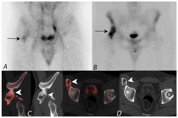 Figure 16